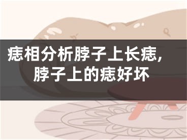 痣相分析脖子上长痣,脖子上的痣好坏