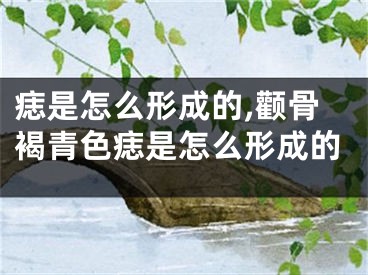 痣是怎么形成的,颧骨褐青色痣是怎么形成的