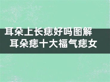 耳朵上长痣好吗图解 耳朵痣十大福气痣女