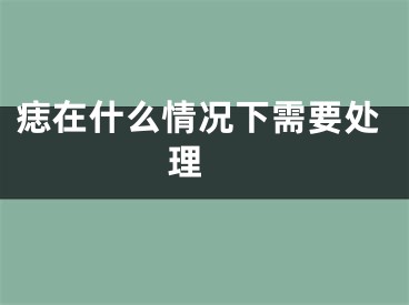 痣在什么情况下需要处理 